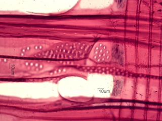 Aesculus glabra, Radial-Section